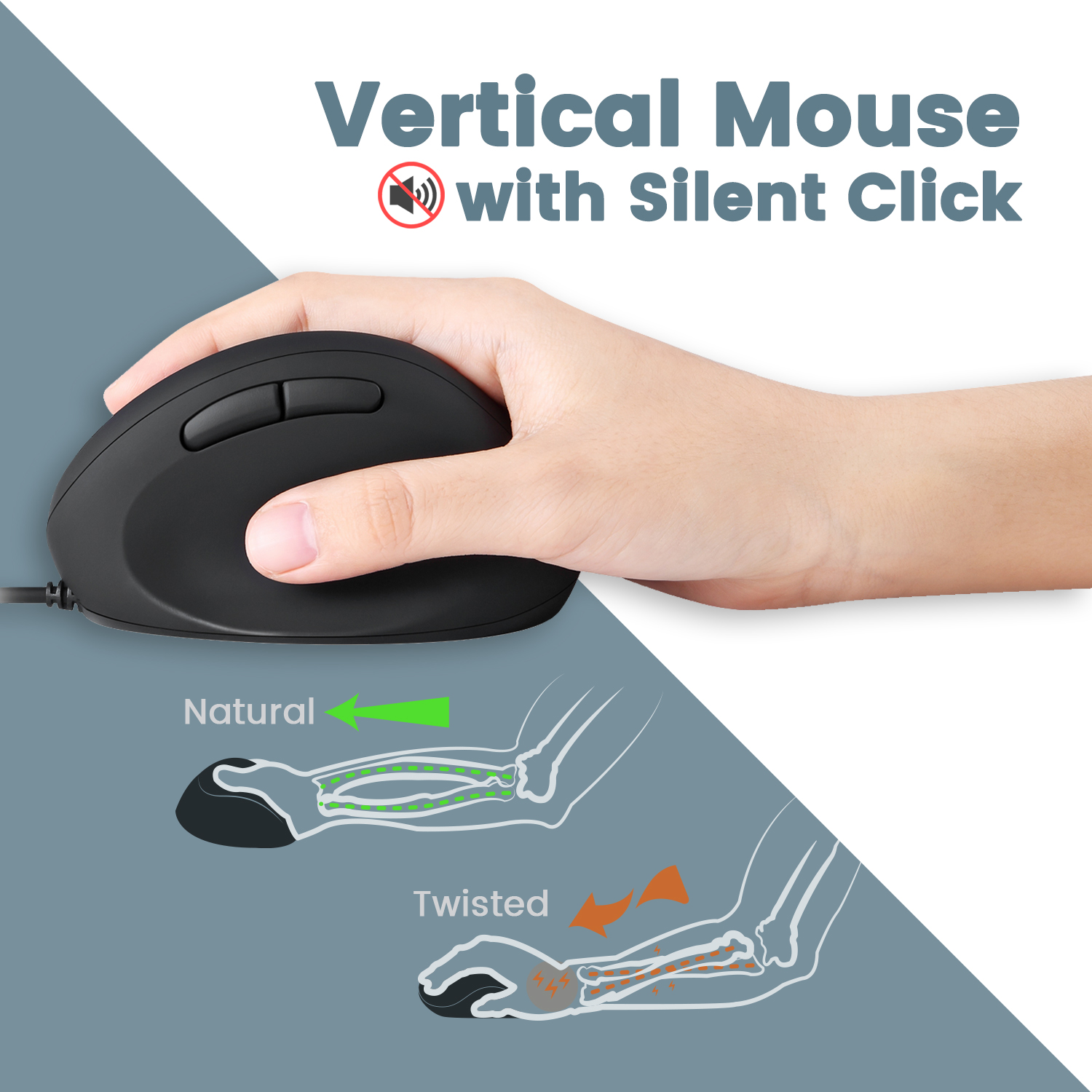 Silent-Click Vertical Mouse